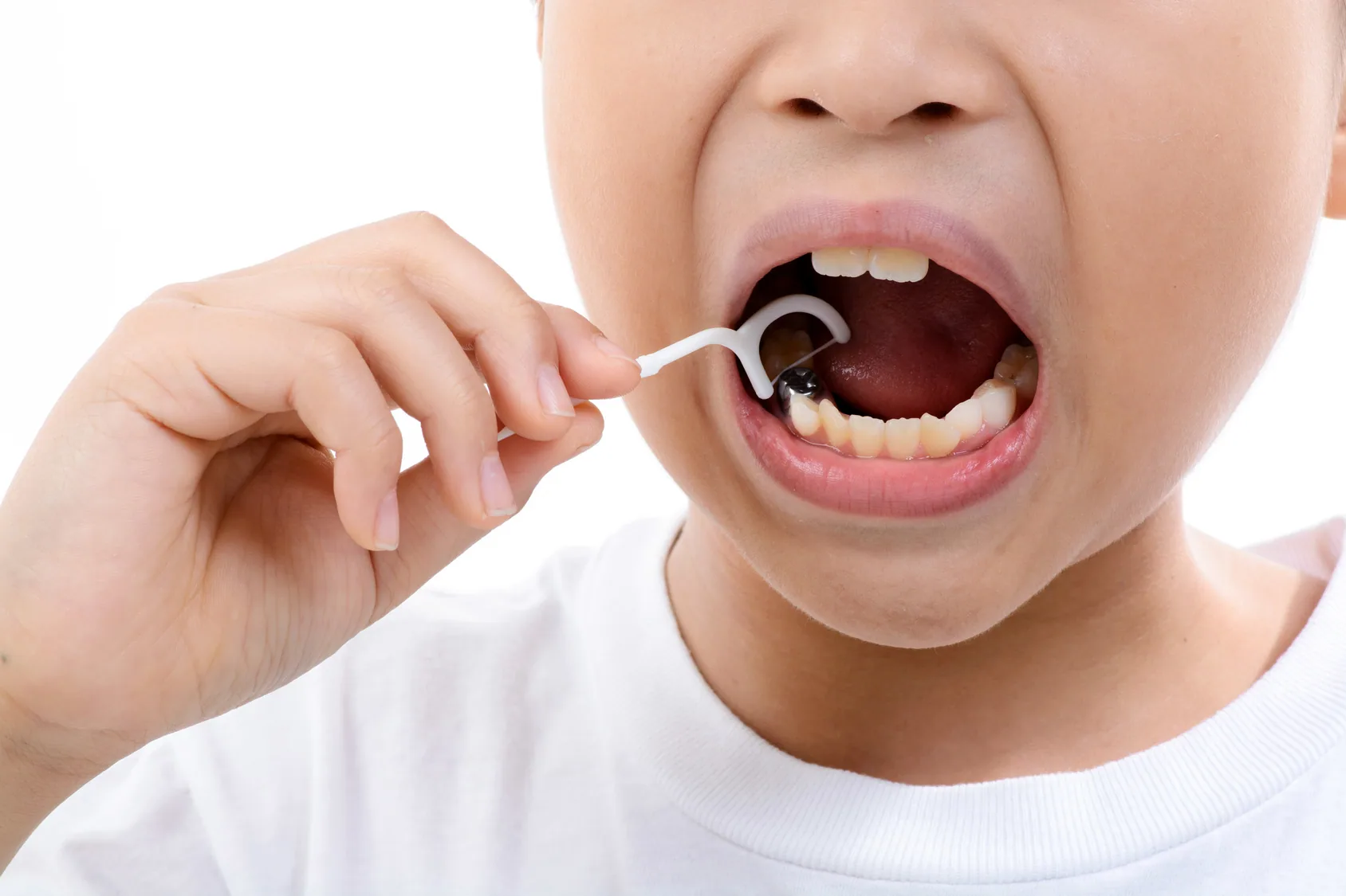 Flossing a child's new adult teeth